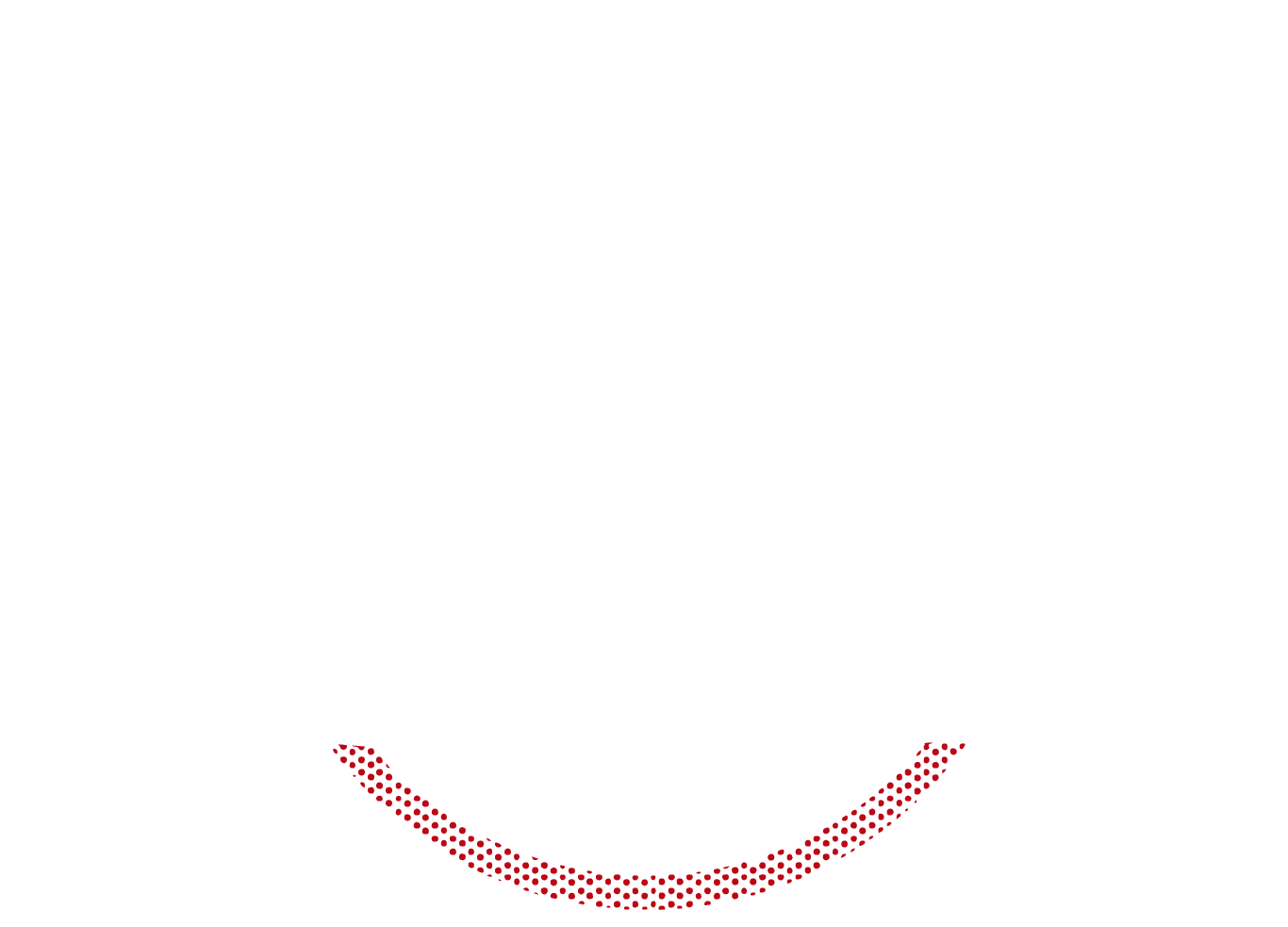 Arco Rovescio
